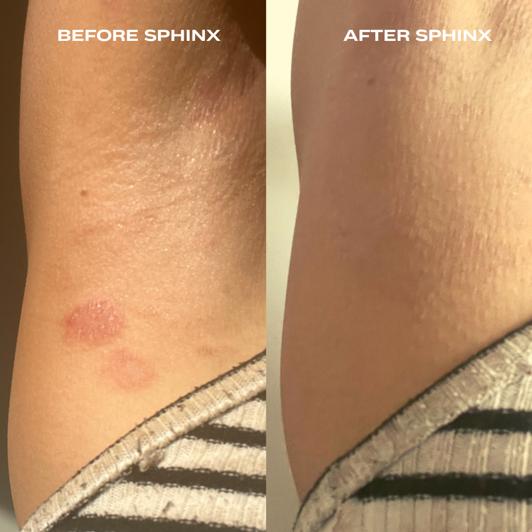 Sphinx Body Experience Oil | For Eczema and Roseacea Relief