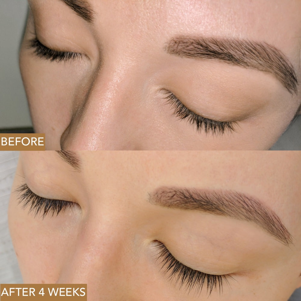 Aphrodite Hair Density Kit